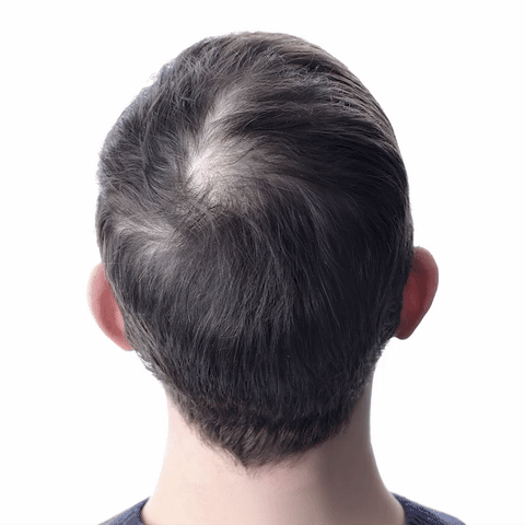 Шампоан за възстановяване на косата Orylo™ RootBoost