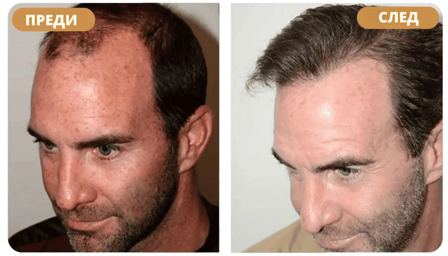 Шампоан за възстановяване на косата Orylo™ RootBoost