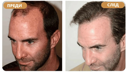 Шампоан за възстановяване на косата Orylo™ RootBoost