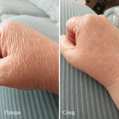 Novaderm™ | Крем за обновяване на кожата 