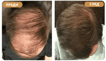 Шампоан за възстановяване на косата Orylo™ RootBoost