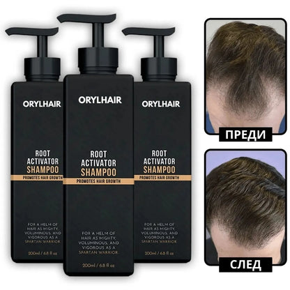 Шампоан за възстановяване на косата Orylo™ RootBoost