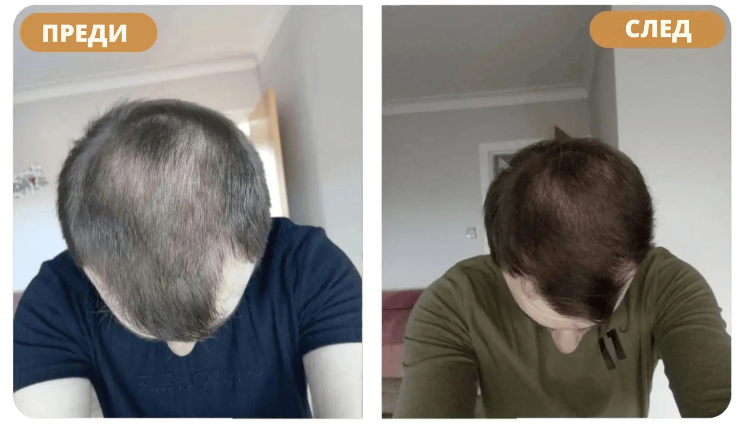 Шампоан за възстановяване на косата Orylo™ RootBoost