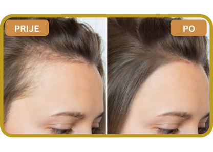 Orylo™ RootBoost Šampon za obnovu kose v2 (Women)