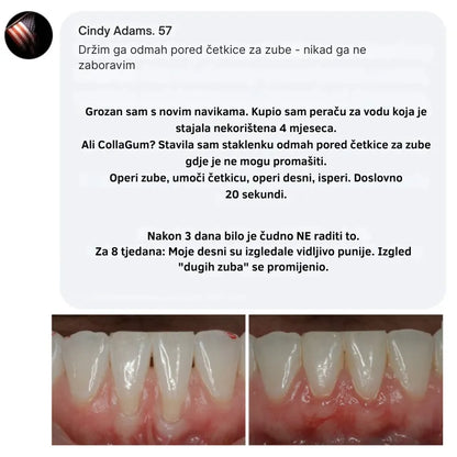 Collagen Powder for Gums