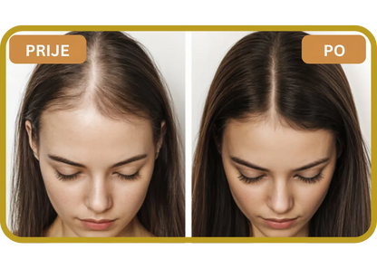 Orylo™ RootBoost Šampon za obnovu kose v2 (Women)