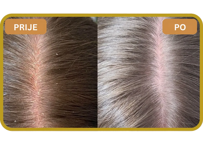 Orylo™ RootBoost Šampon za obnovu kose v2 (Women)