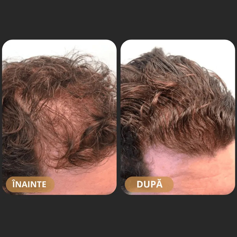 Шампоан за възстановяване на косата Orylo™ RootBoost