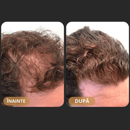 Шампоан за възстановяване на косата Orylo™ RootBoost