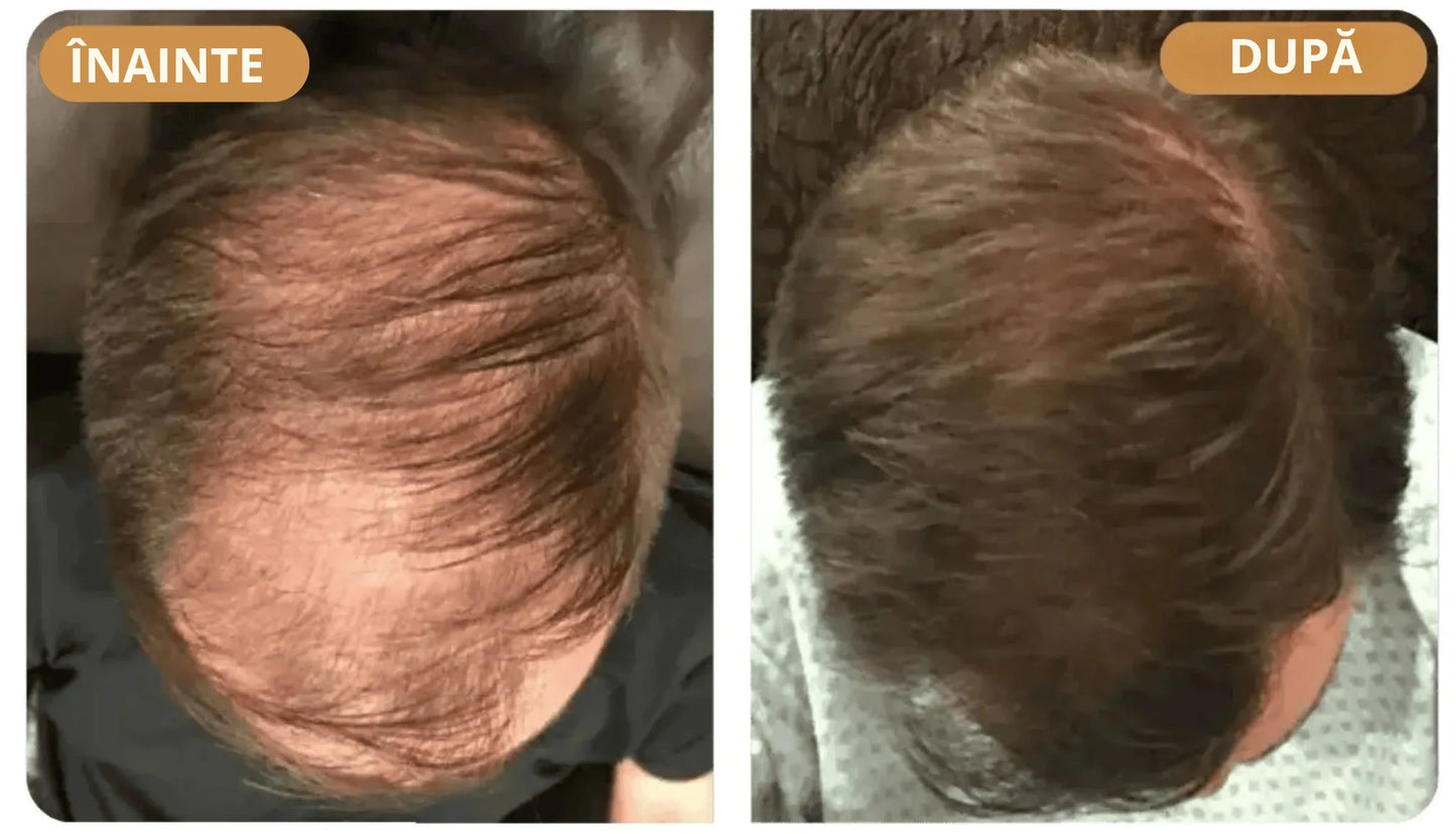 Шампоан за възстановяване на косата Orylo™ RootBoost