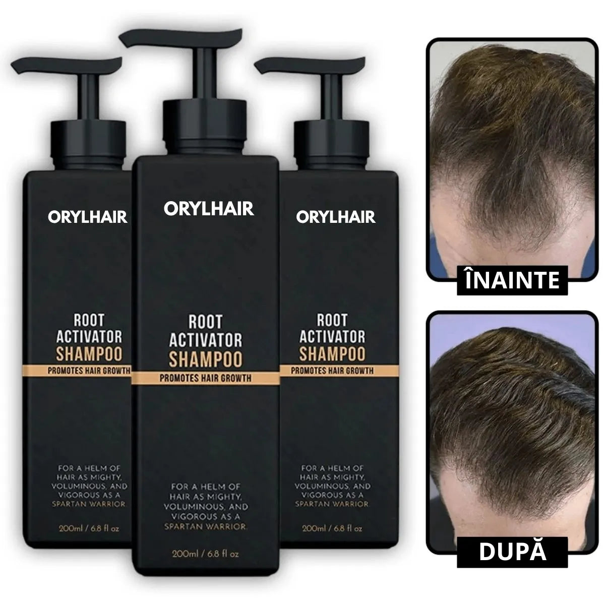 Шампоан за възстановяване на косата Orylo™ RootBoost