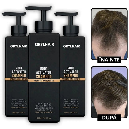 Шампоан за възстановяване на косата Orylo™ RootBoost